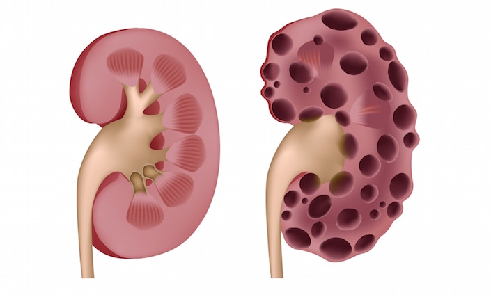 common-habits-that-damage-kidneys.jpg